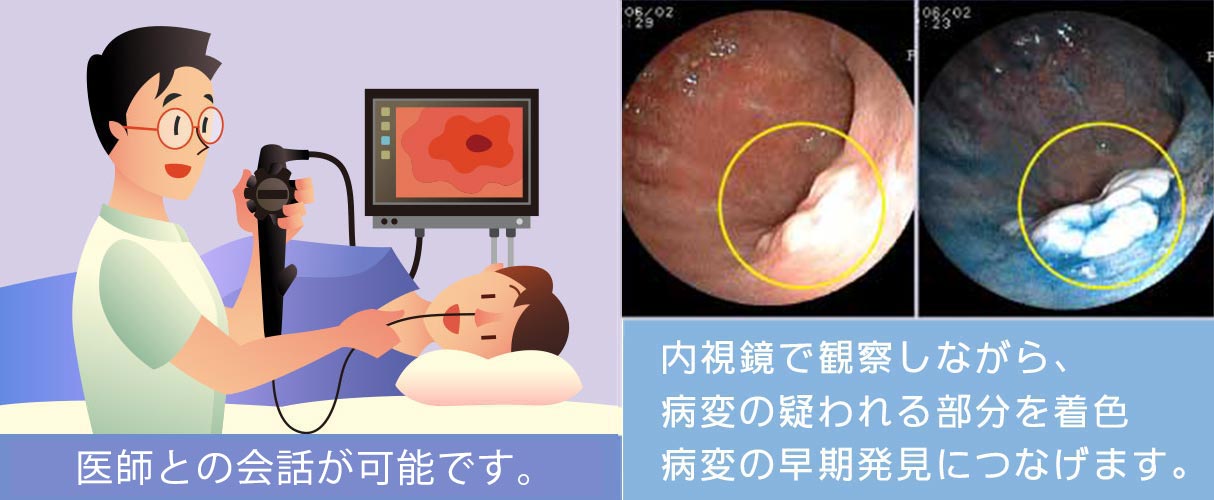 胃がんの早期発見のカギは内視鏡検査とピロリ菌