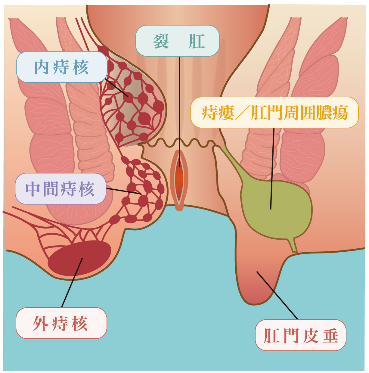 イメージ画像