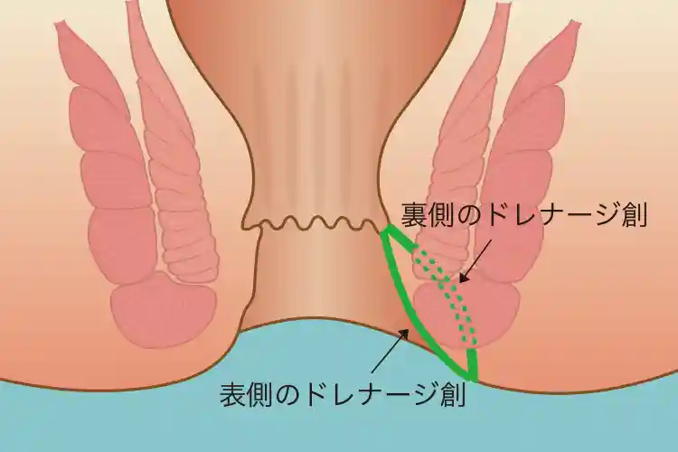 イメージ画像