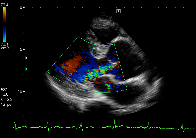 心臓の超音波画像