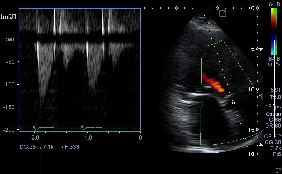心臓超音波画像