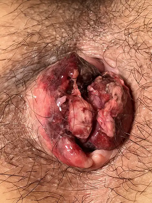 手術前の写真