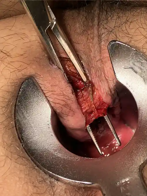 周堤を蒸散後の写真