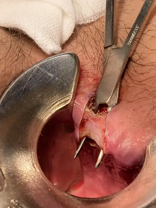 周堤を蒸散後の写真