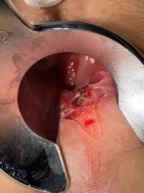 周堤を蒸散後の写真