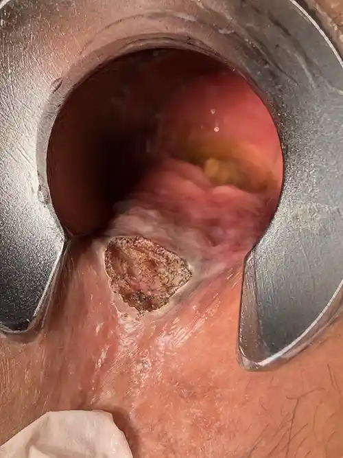 周堤を蒸散後の写真