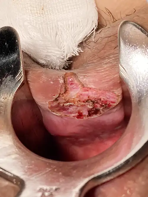 周堤を蒸散の写真