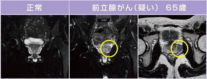 男性の病気