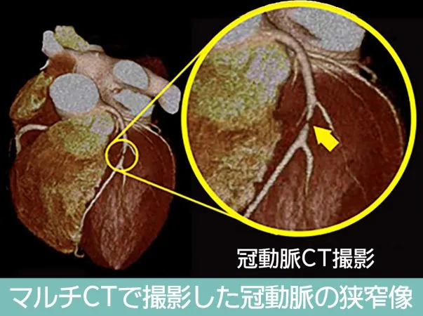 疾患の検査から探す