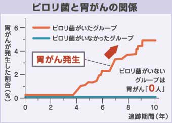 胃がんの検査
