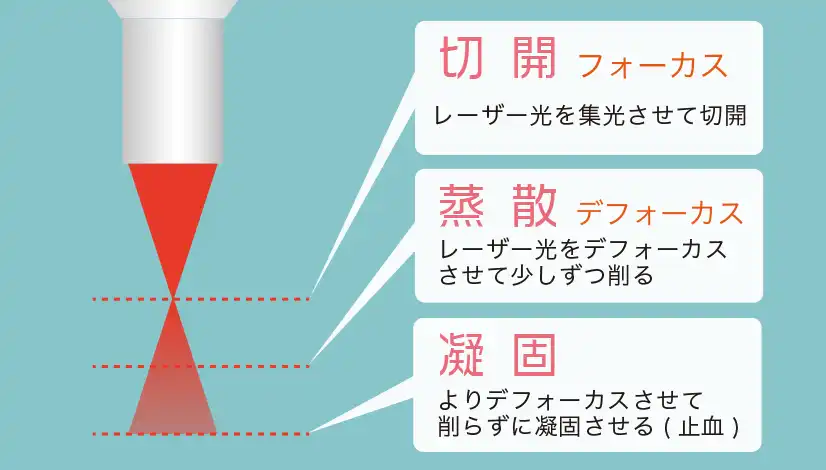 レーザー光の説明