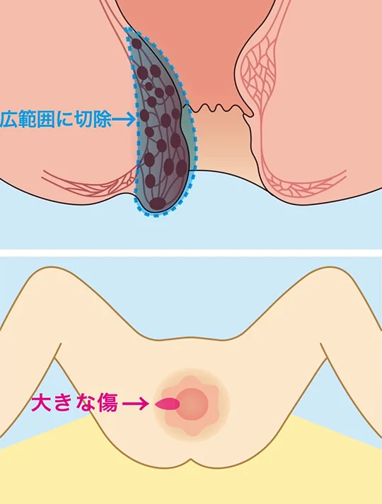 イラスト