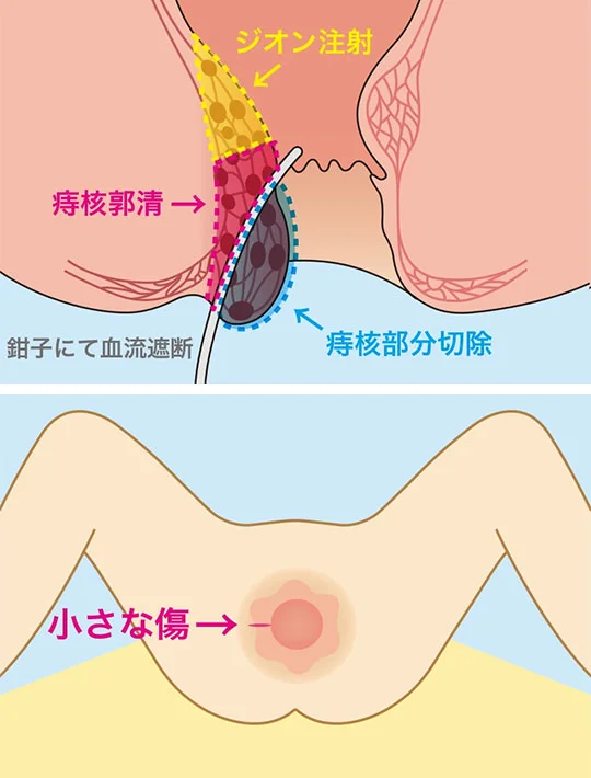 イラスト