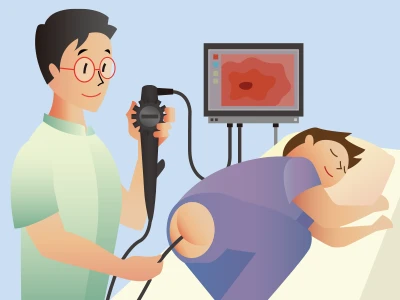 内視鏡検査のイメージイラスト