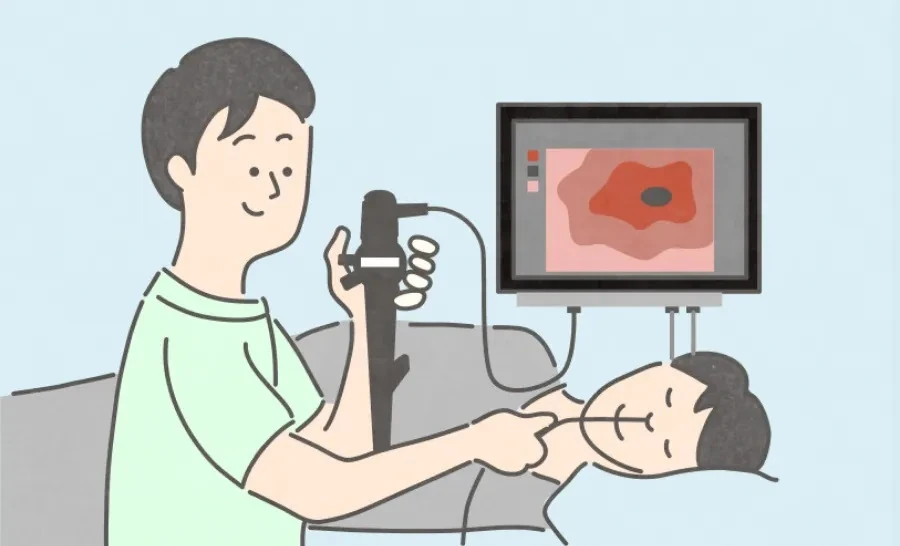 胃内視鏡検査のイメージ