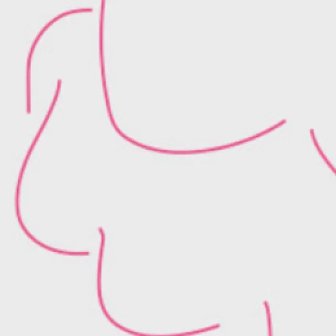 DWIBS(ドゥイブス)による乳がん画像