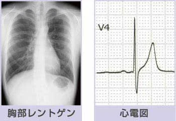 一般の健康診断の様子