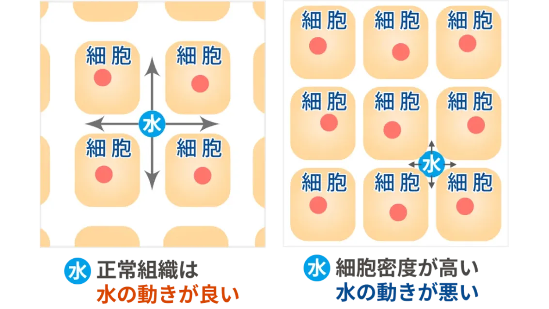 DWIBS(ドゥイブス)検査で撮影できる全身の部位