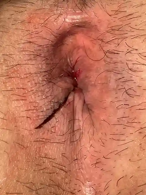 手術直後の症例写真