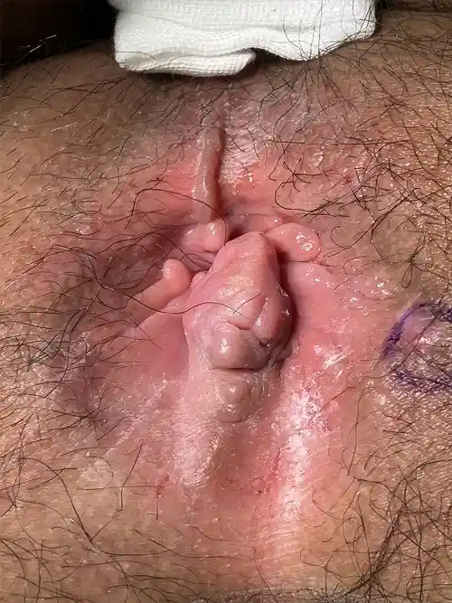 手術前の症例写真