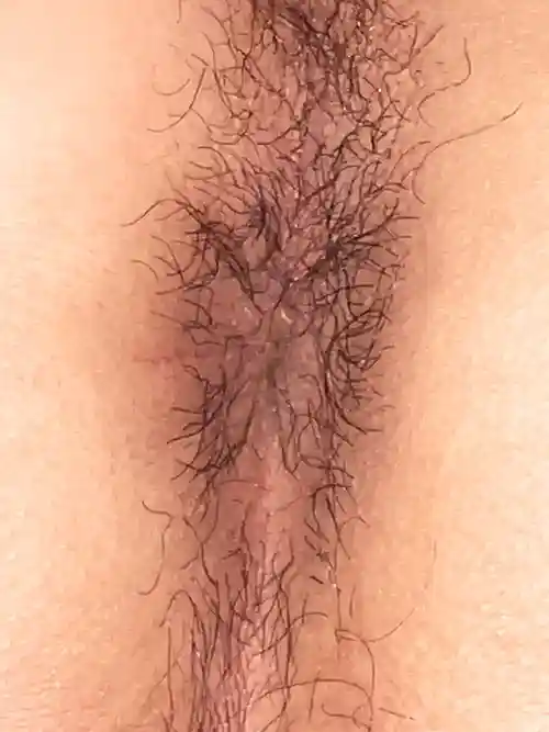 3週間後の症例写真