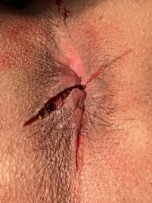手術直後の症例写真