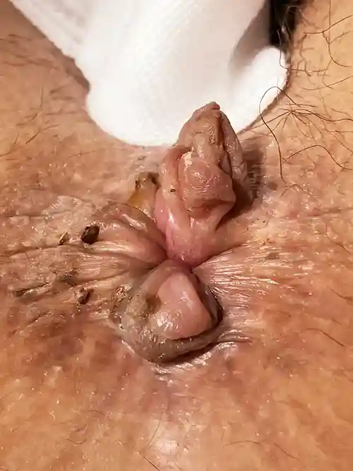 手術前の症例写真