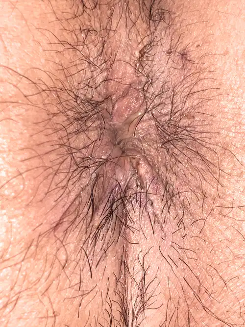 翌日の症例写真