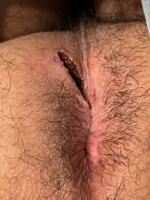 手術直後の症例写真