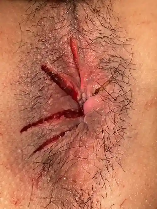 手術直後の症例写真